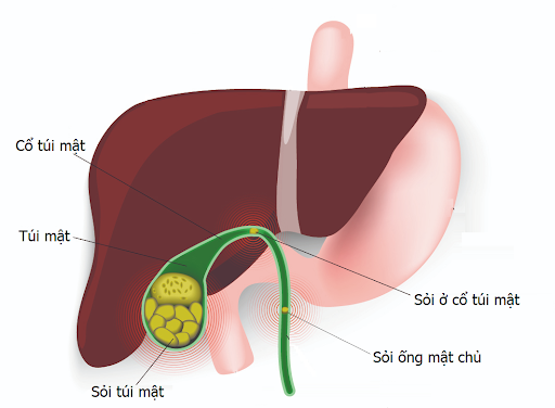 soi-mat-co-the-gay-ra-tinh-trang-vang-da.png